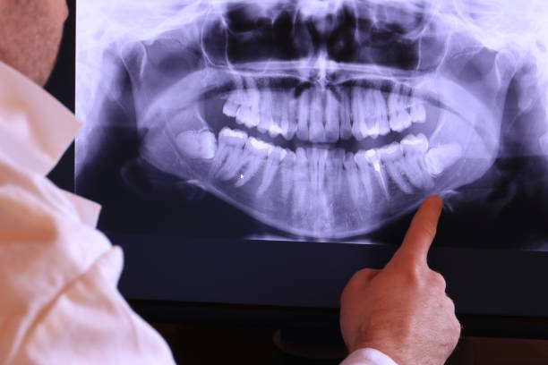 Best Emergency Tooth Extraction in Whitfield, PA