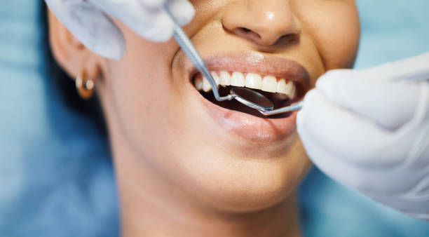 Best Emergency Dental Care for Broken or Chipped Teeth in Whitfield, PA